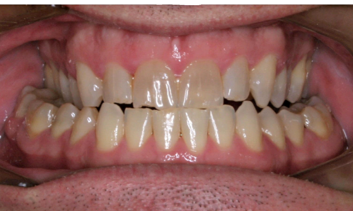 About Orthodontics Rix Orthodontics Calgary AB